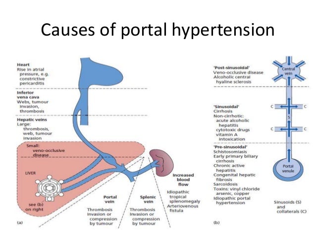 portal hypertension blood pressure